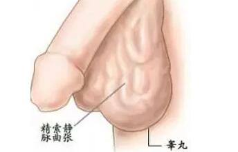 精索靜脈曲張，手術(shù)還是等待？