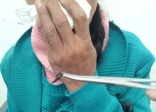 雞皮疙瘩掉一地，鼻子出螞蟥就在你身邊，你還敢喝生水嗎？