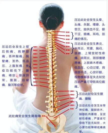 保護(hù)腰椎—示范腰椎保健操，趕快收藏吧