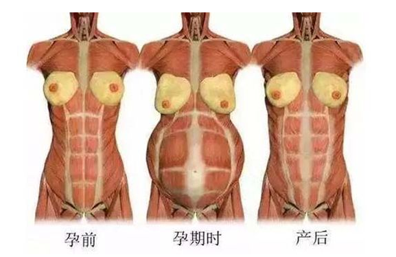 產(chǎn)后媽媽骨盆修復(fù)――帶你回到完美身材！