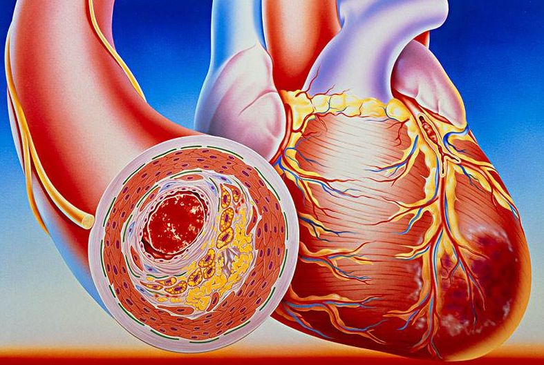 看清心臟動(dòng)脈，判斷病癥，及早治療冠心?。?></a></div>
               
 					<div   id=