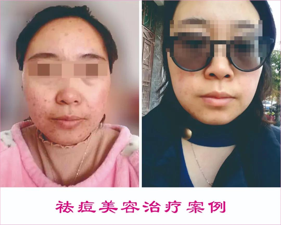 中醫(yī)駐顏，標(biāo)本兼治|中醫(yī)養(yǎng)生駐顏保健治療中心