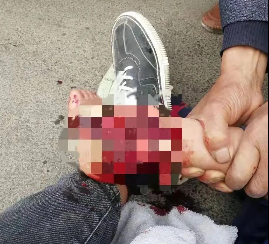 【保山安利醫(yī)院】創(chuàng)傷急救到處跑，不如安利把醫(yī)找！