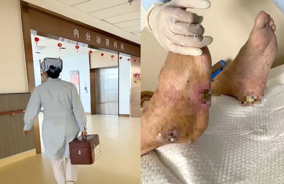 【保山安利醫(yī)院】傷口治療一站式，健康生活零距離！